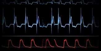 Intermountain Healthcare